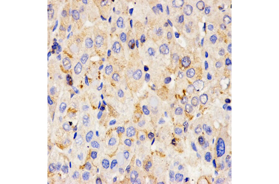 Immunohistochemistry - CHI3L1 antibody from Signalway Antibody (38608) - Antibodies.com