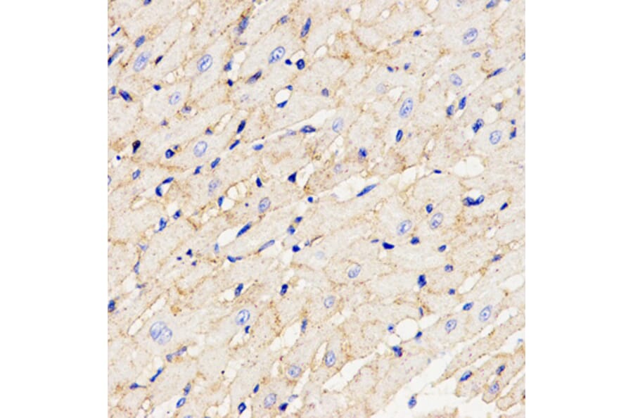 Immunohistochemistry - CHI3L1 antibody from Signalway Antibody (38608) - Antibodies.com