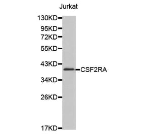 Western blot - CSF2RA antibody from Signalway Antibody (38609) - Antibodies.com