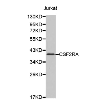 Western blot - CSF2RA antibody from Signalway Antibody (38609) - Antibodies.com