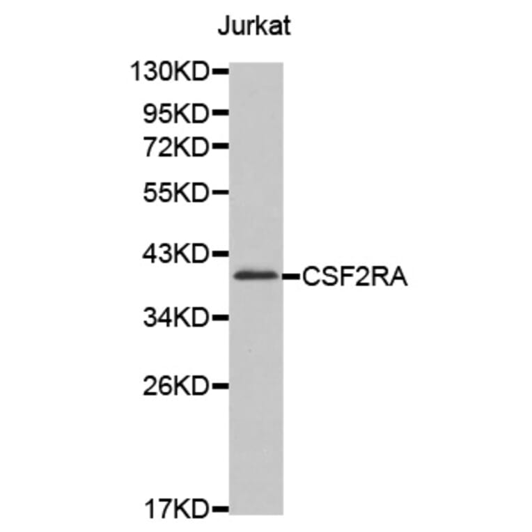 Western blot - CSF2RA antibody from Signalway Antibody (38609) - Antibodies.com