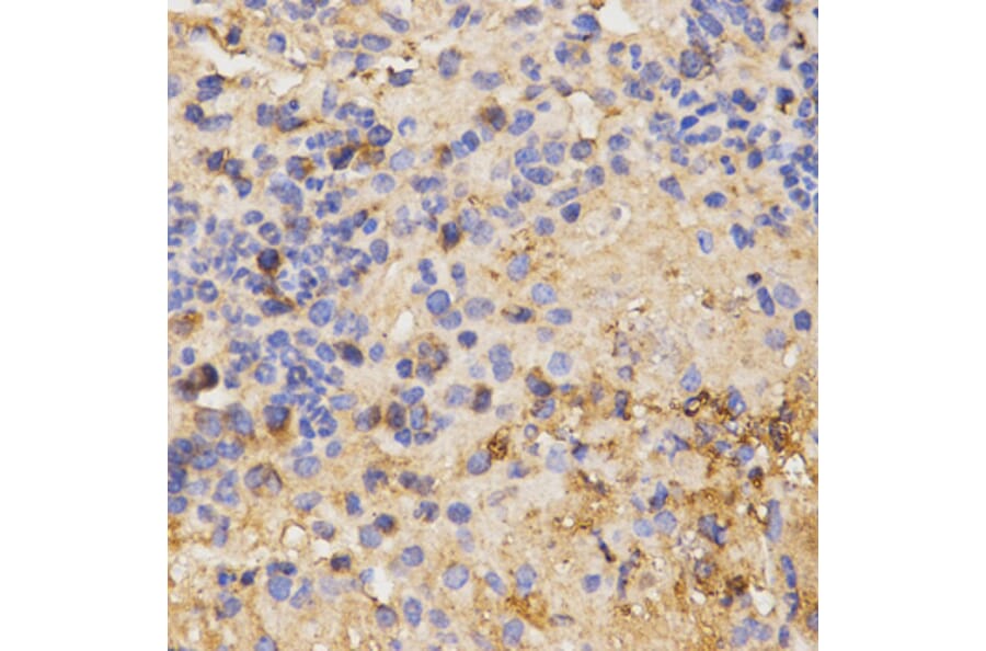 Immunohistochemistry - CSF2RA antibody from Signalway Antibody (38609) - Antibodies.com
