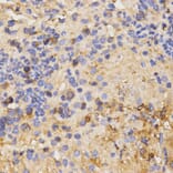 Immunohistochemistry - CSF2RA antibody from Signalway Antibody (38609) - Antibodies.com