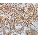 Immunohistochemistry - PECAM1 antibody from Signalway Antibody (38622) - Antibodies.com