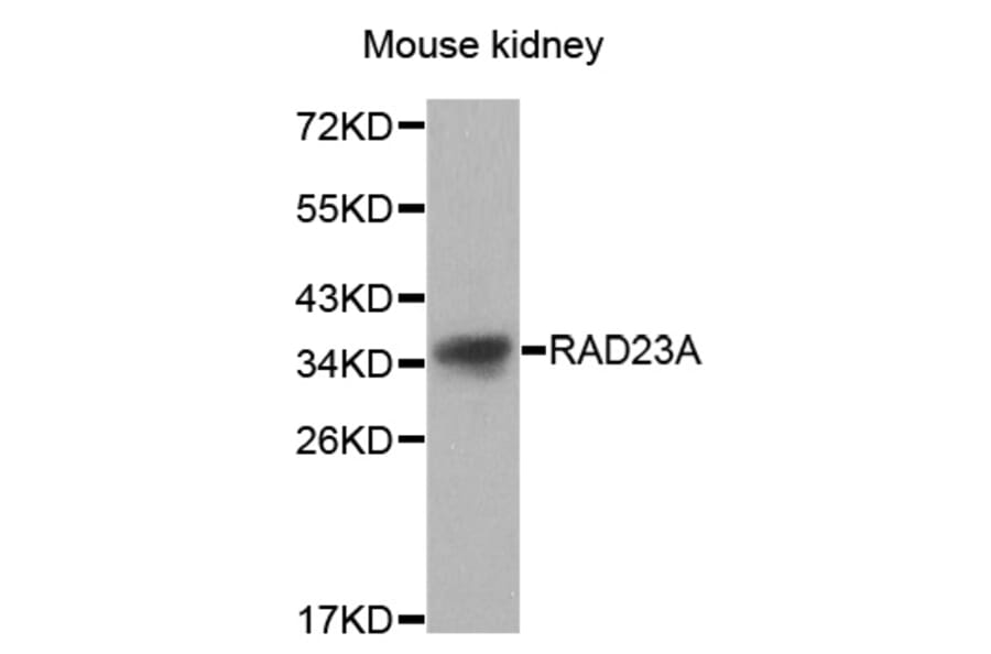 Western blot - RAD23A antibody from Signalway Antibody (38627) - Antibodies.com