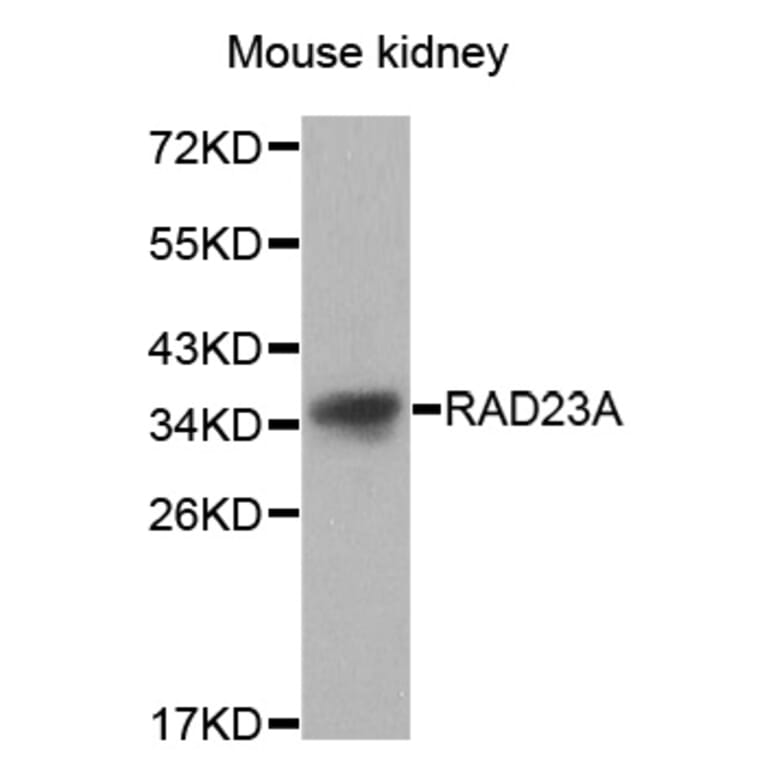 Western blot - RAD23A antibody from Signalway Antibody (38627) - Antibodies.com