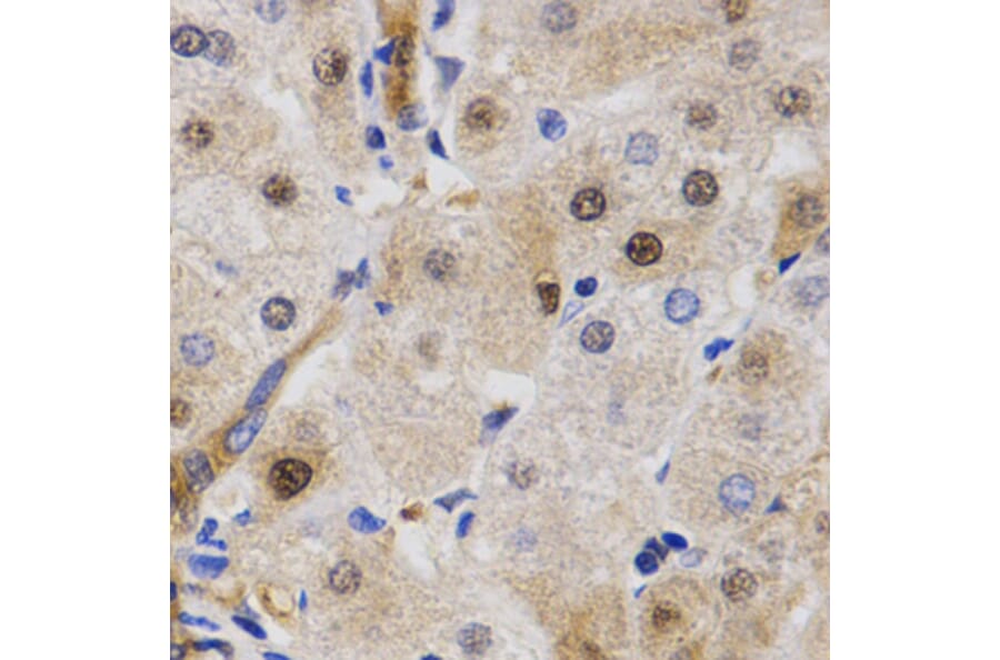 Immunohistochemistry - RAD23A antibody from Signalway Antibody (38627) - Antibodies.com