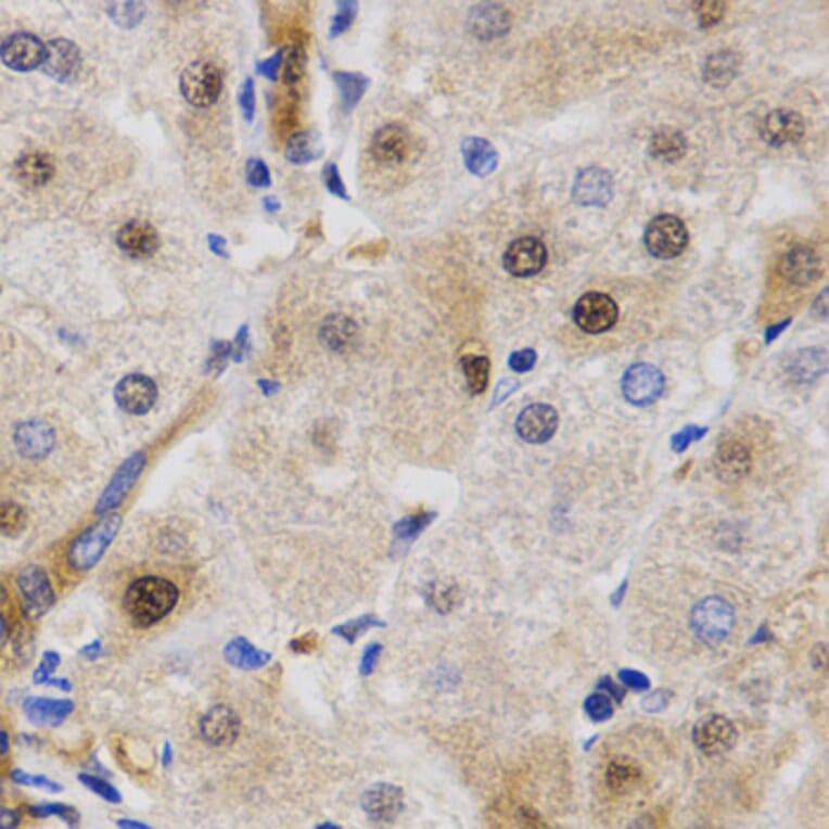Immunohistochemistry - RAD23A antibody from Signalway Antibody (38627) - Antibodies.com