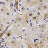 Immunohistochemistry - RAD23A antibody from Signalway Antibody (38627) - Antibodies.com
