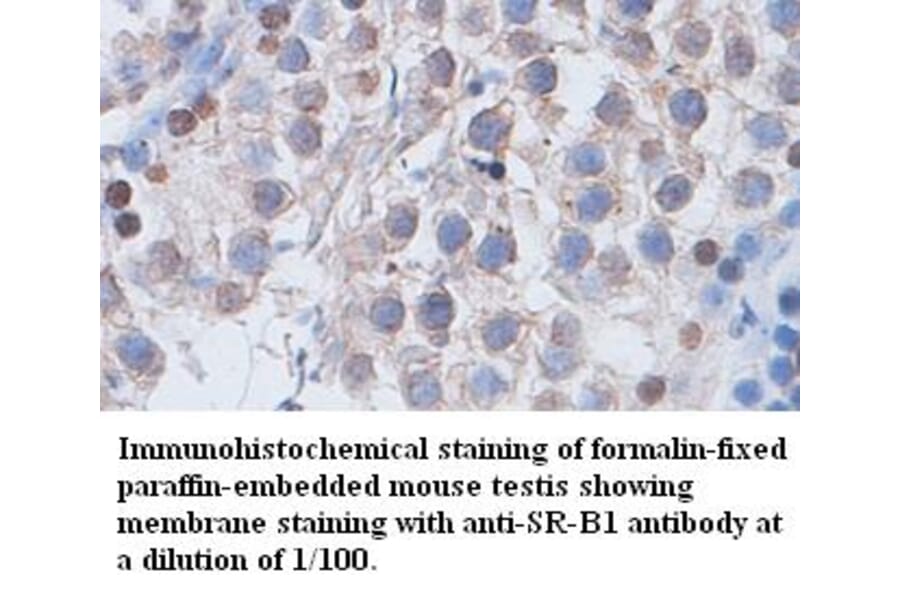SR-B1 Antibody from Signalway Antibody (39400) - Antibodies.com