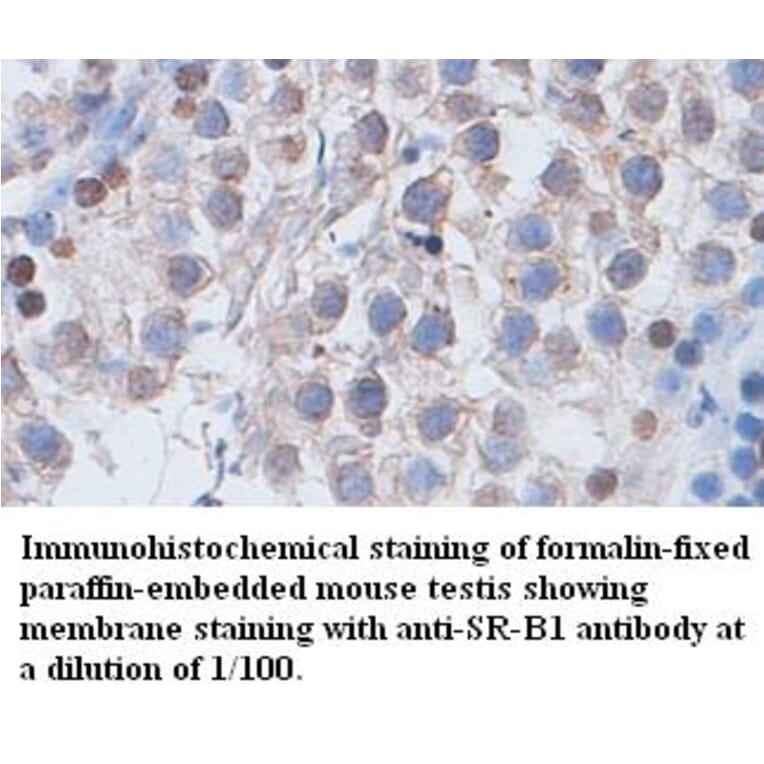 SR-B1 Antibody from Signalway Antibody (39400) - Antibodies.com