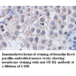 SR-B1 Antibody from Signalway Antibody (39400) - Antibodies.com