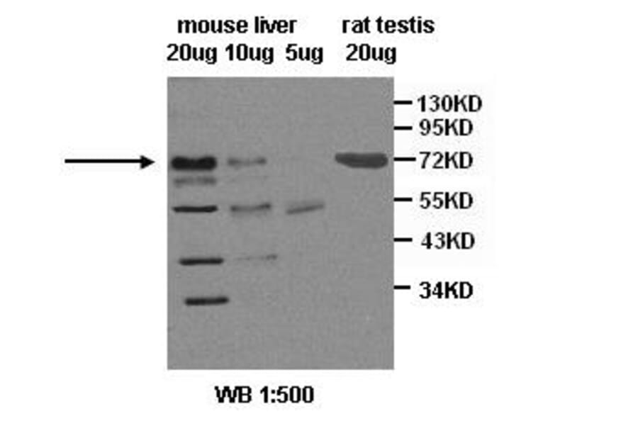 SR-B1 Antibody from Signalway Antibody (39400) - Antibodies.com