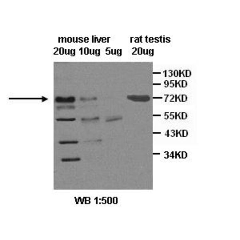 SR-B1 Antibody from Signalway Antibody (39400) - Antibodies.com