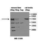 SR-B1 Antibody from Signalway Antibody (39400) - Antibodies.com