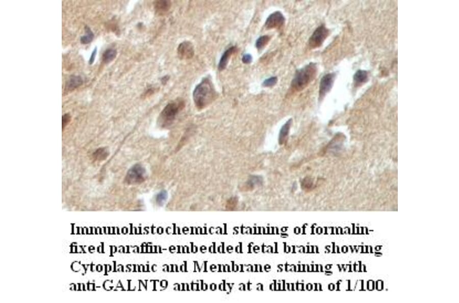 GALNT9 Antibody from Signalway Antibody (39419) - Antibodies.com