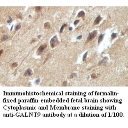 GALNT9 Antibody from Signalway Antibody (39419) - Antibodies.com