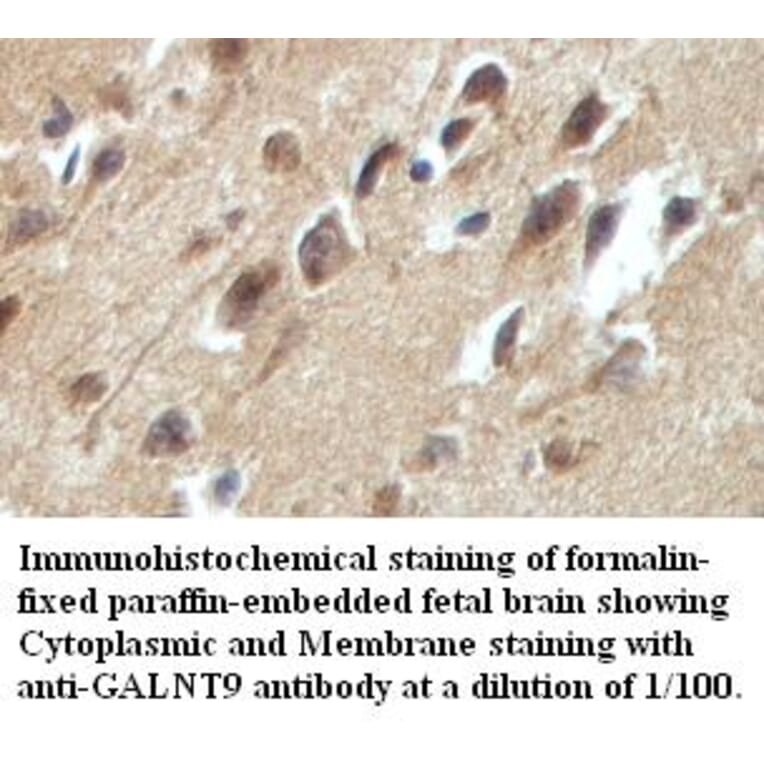 GALNT9 Antibody from Signalway Antibody (39419) - Antibodies.com