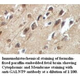 GALNT9 Antibody from Signalway Antibody (39419) - Antibodies.com