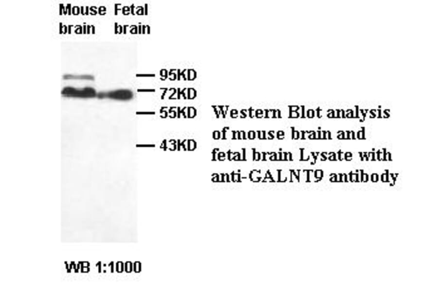 GALNT9 Antibody from Signalway Antibody (39419) - Antibodies.com