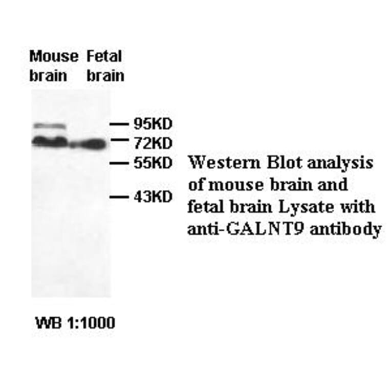 GALNT9 Antibody from Signalway Antibody (39419) - Antibodies.com