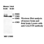 GALNT9 Antibody from Signalway Antibody (39419) - Antibodies.com