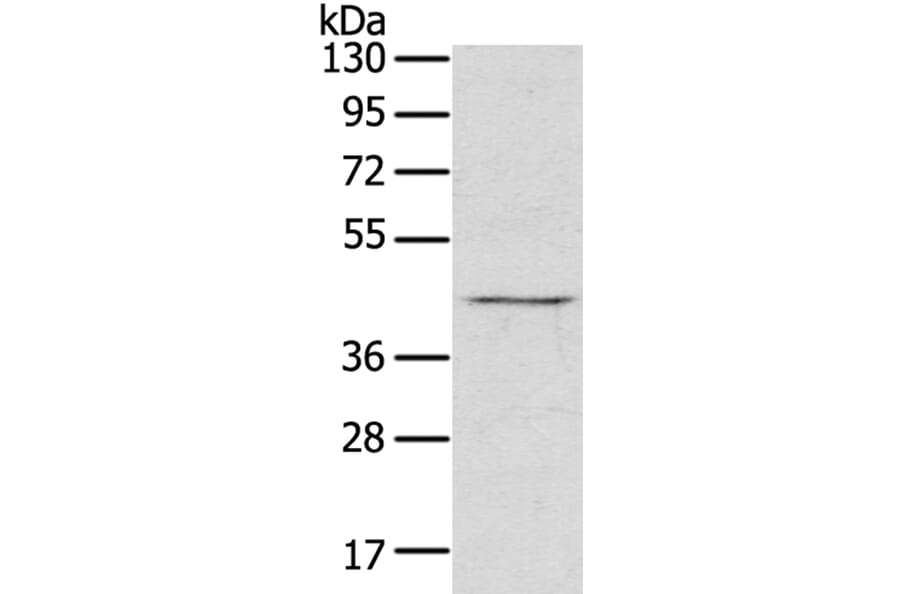 RASSF7 Antibody from Signalway Antibody (40072) - Antibodies.com