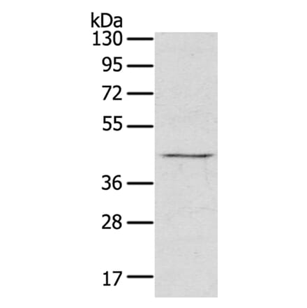 RASSF7 Antibody from Signalway Antibody (40072) - Antibodies.com