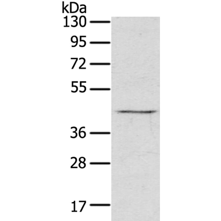 RASSF7 Antibody from Signalway Antibody (40072) - Antibodies.com