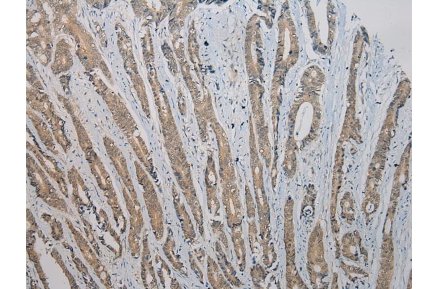 Immunohistochemistry - RASSF7 Antibody from Signalway Antibody (40072) - Antibodies.com