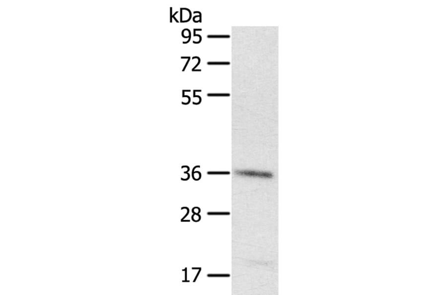 PDLIM4 Antibody from Signalway Antibody (40077) - Antibodies.com