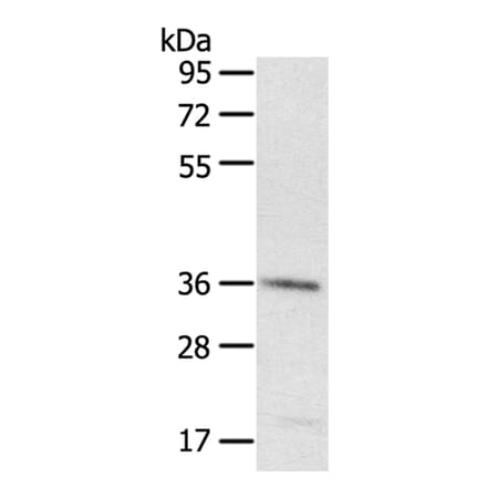 PDLIM4 Antibody from Signalway Antibody (40077) - Antibodies.com