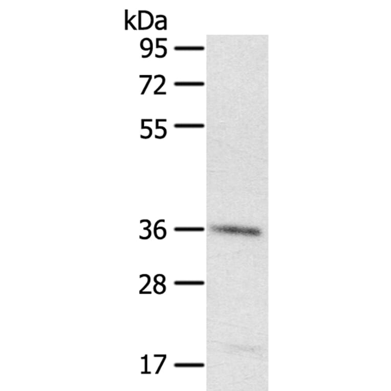 PDLIM4 Antibody from Signalway Antibody (40077) - Antibodies.com