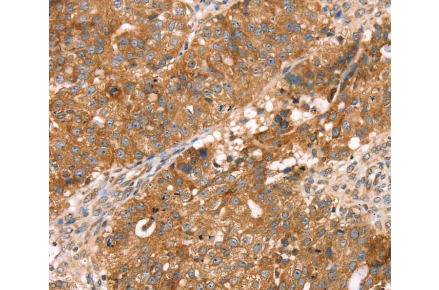 Immunohistochemistry - PDLIM4 Antibody from Signalway Antibody (40077) - Antibodies.com