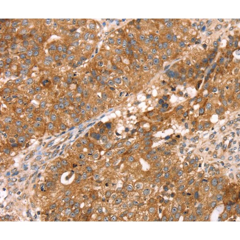 Immunohistochemistry - PDLIM4 Antibody from Signalway Antibody (40077) - Antibodies.com