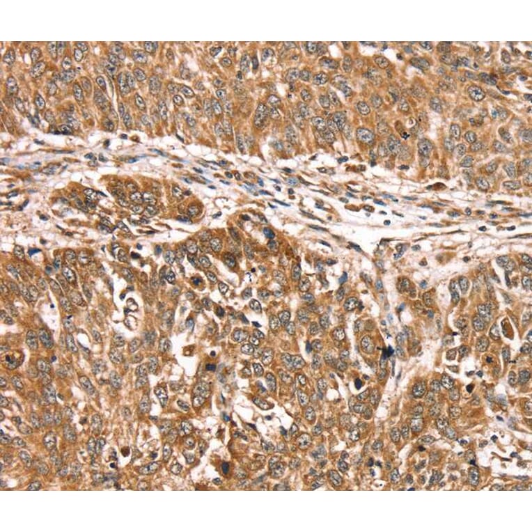 Immunohistochemistry - PDLIM4 Antibody from Signalway Antibody (40077) - Antibodies.com
