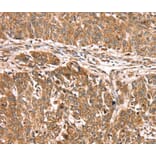 Immunohistochemistry - PDLIM4 Antibody from Signalway Antibody (40077) - Antibodies.com