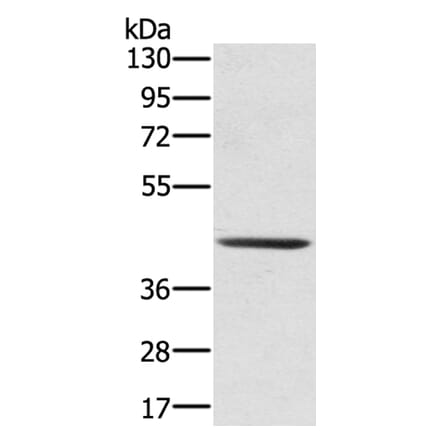 SCPEP1 Antibody from Signalway Antibody (40078) - Antibodies.com