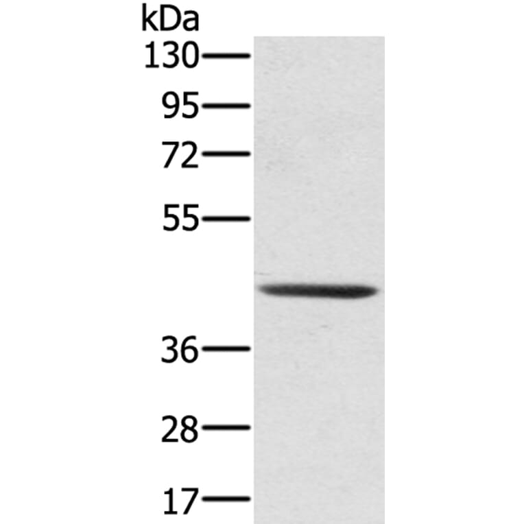 SCPEP1 Antibody from Signalway Antibody (40078) - Antibodies.com