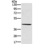 SCPEP1 Antibody from Signalway Antibody (40078) - Antibodies.com