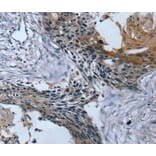 Immunohistochemistry - TRIM31 Antibody from Signalway Antibody (40079) - Antibodies.com