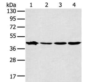 MAPK12 Antibody from Signalway Antibody (40092) - Antibodies.com