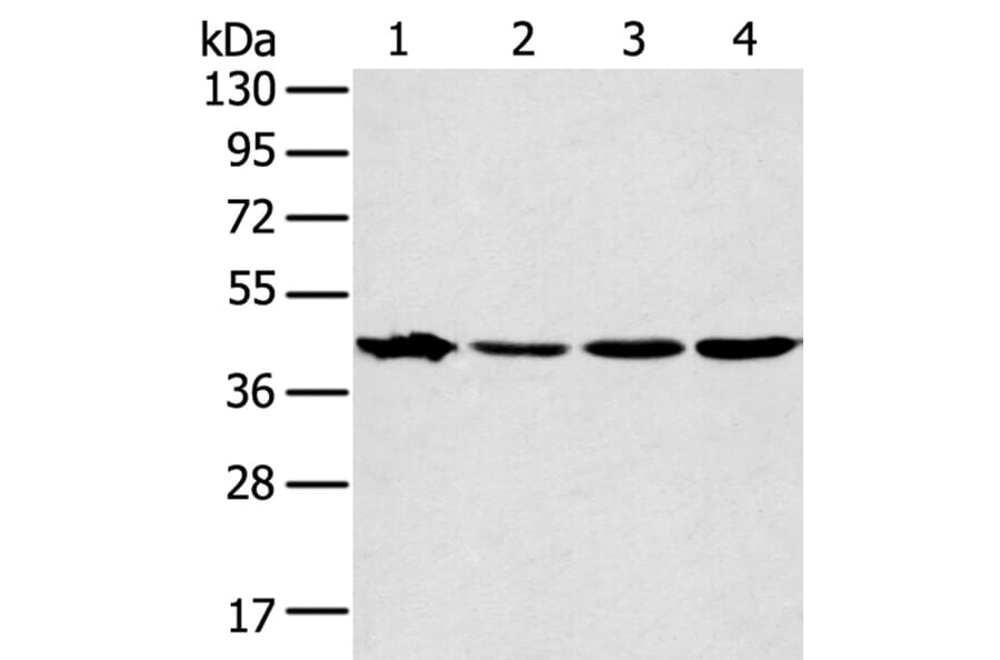 MAPK12 Antibody from Signalway Antibody (40092) - Antibodies.com