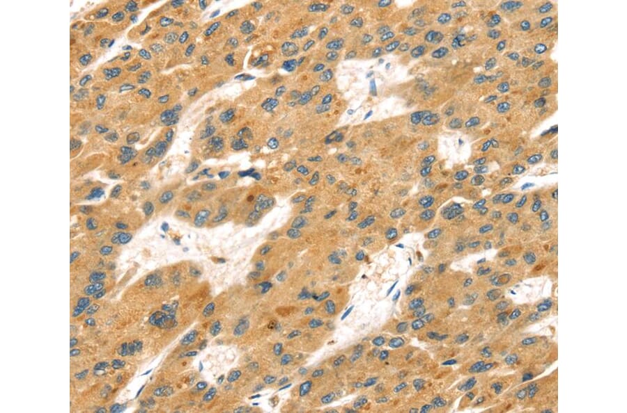 Immunohistochemistry - MAPK12 Antibody from Signalway Antibody (40092) - Antibodies.com