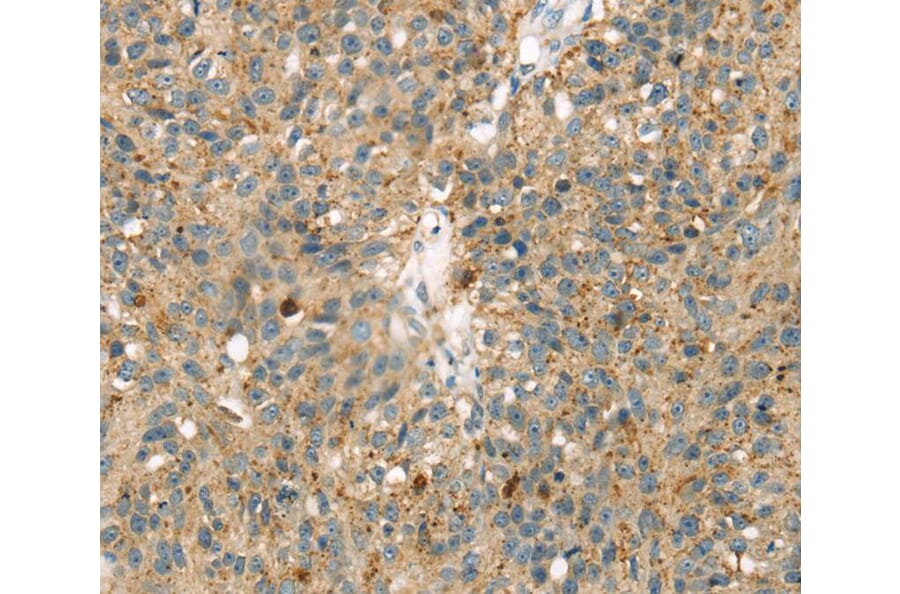 Immunohistochemistry - MAPK12 Antibody from Signalway Antibody (40092) - Antibodies.com