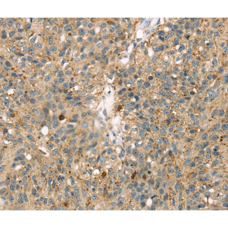 Immunohistochemistry - MAPK12 Antibody from Signalway Antibody (40092) - Antibodies.com