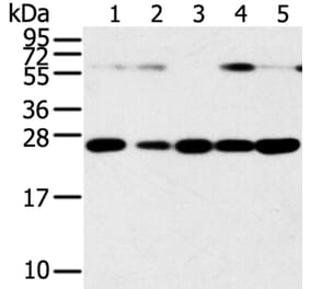 SNAP23 Antibody from Signalway Antibody (40111) - Antibodies.com