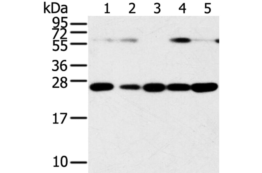 SNAP23 Antibody from Signalway Antibody (40111) - Antibodies.com