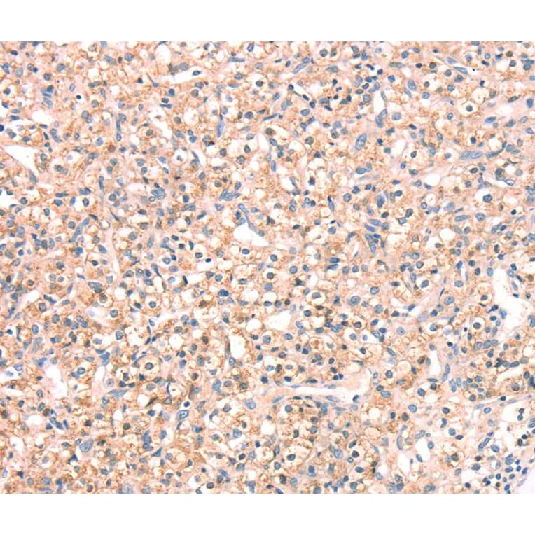 Immunohistochemistry - SNAP23 Antibody from Signalway Antibody (40111) - Antibodies.com