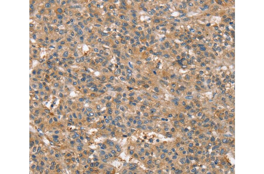 Immunohistochemistry - SSX2IP Antibody from Signalway Antibody (40119) - Antibodies.com